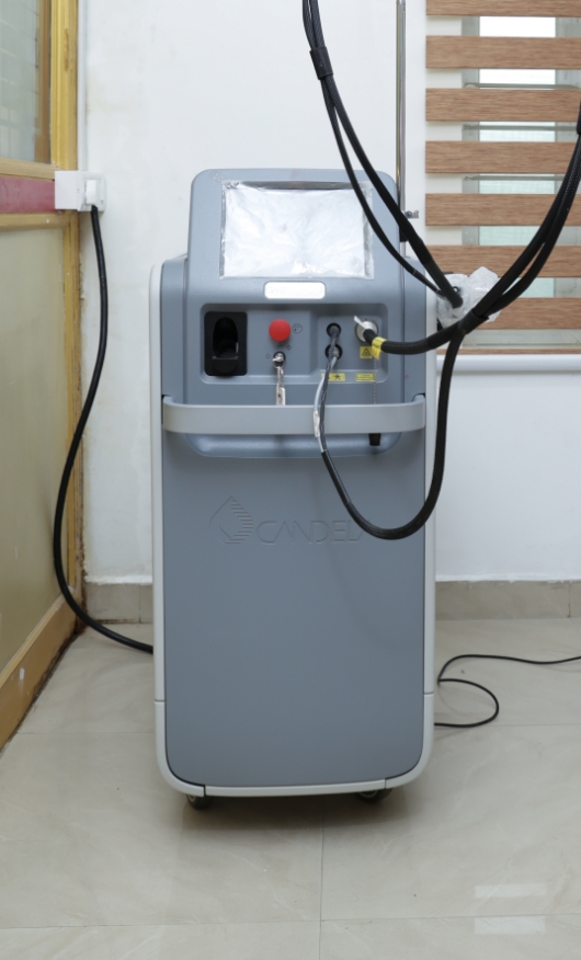 Laser equipment at AKJ Skin & Laser Centre, Chennai for treating port wine stains.