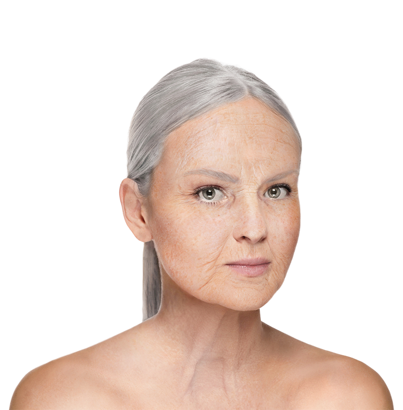 A woman with wrinkles and a dull face before anti-ageing treatment.