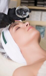 A close-up shot of a female patient undergoing a chemical peeling procedure.