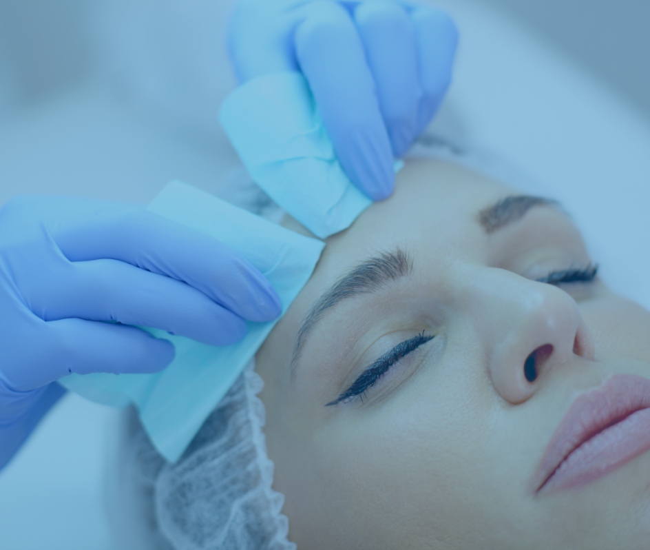 A close-up shot of a woman undergoing a laser acne treatment procedure.