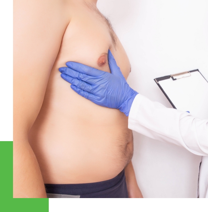 A male patient is examined for Gynecomastia before plastic surgery.