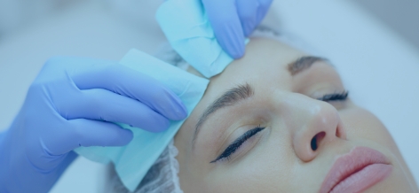 A close-up shot of a woman undergoing a laser acne treatment procedure.